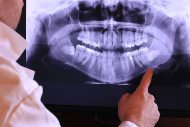 Best Emergency Dental Extractions in Jefferson City, TN